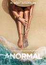 Anormal 